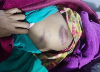 बोक्सीको आरोपमा मरणासन्न हुने गरी कुटपिटअचेत भएपछि उनलाई आईसीयूमा उपचार हुँदै